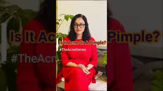 Is it acne or pimple? By Dr Rashmi shetty