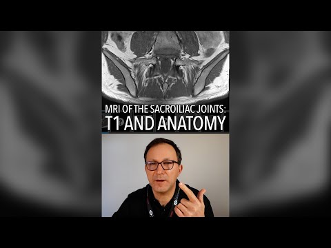 How to recognize a T1 weighted MRI scan and basic anatomy of the sacroiliac joint // THE BASICS