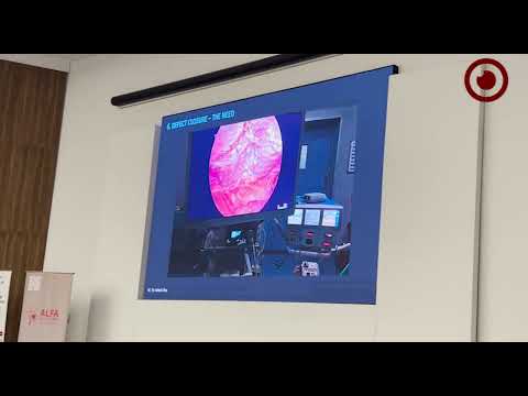 YouTube video