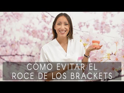 ¿Cómo usar la cera dental para brackets?