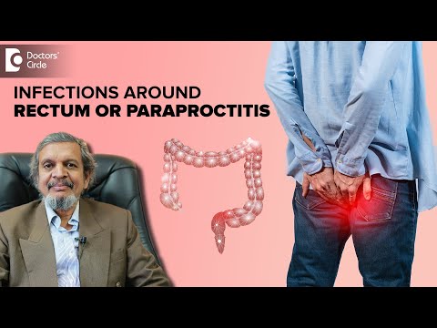 Know why you get Infections around Anus | Paraproctitis - Dr. Rajasekhar M R | Doctors' Circle