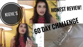 Hyperpigmentation #kiehls Dark Spot Solution, 60 Days Challenge - Is it worth the Hype