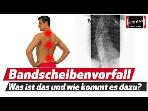 ÐÐи Ð³Ñ € уÐного оÑ, ÐÐμÐ »Ð ° Preis arthroskopischen Resektion des Meniskus des Kniegelenks
