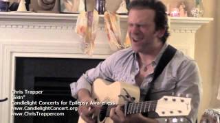 Chris Trapper - Skin at Candlelight Concerts for Epilepsy Awareness
