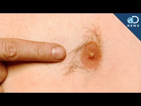 なぜ男性には乳首があるのか？ (Why Do Men Have Nipples?)