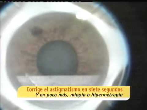 Operación de miopia - Andalucía directo -  Antonio Montero