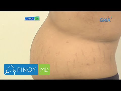 Gatas diyeta sa mawala timbang ng mabilis Alisin ang tiyan taba at balat