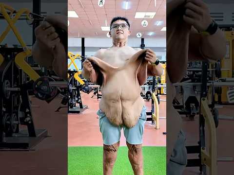 كان وزنه 264 كجم .. وقرار واحد غير مصير حياته !!