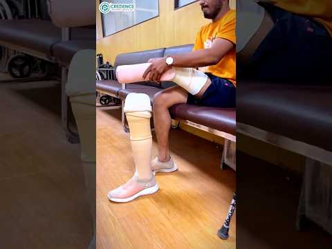 Price of Artificial Leg in India | 20,000 | Padeline Liner | Credence Prosthetic India | #ossurindia