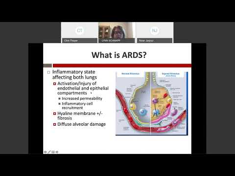 4/24/2020: ARDS: Days of Future Past