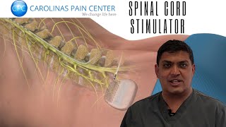 Dr. Shah: Why SCS may be your best option!