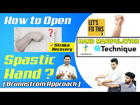 HAND MANIPULATION TECHNIQUE TO FACILITATE FINGER EXTENSION(RELEASING) IN STROKE/HEMIPLEGIA PATIENTS.
