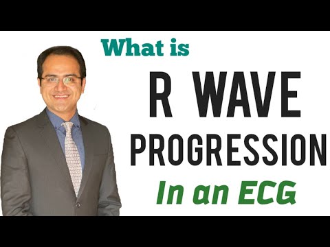 R Wave Progression in ECG, R Wave Abnormalities in an ECG, ECG Lectures USMLE, Neet pg