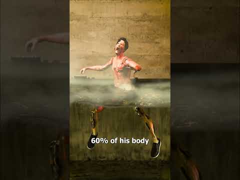 He Fell Into Boiling Water 😱