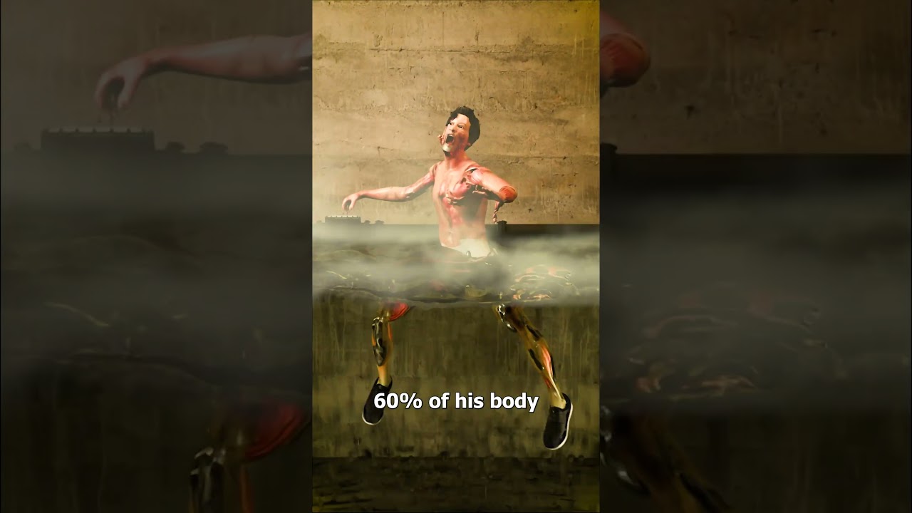 He Fell Into Boiling Water 😱