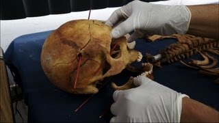 From Guatemalan Soil, Scientists Unearth Signs of Genocide