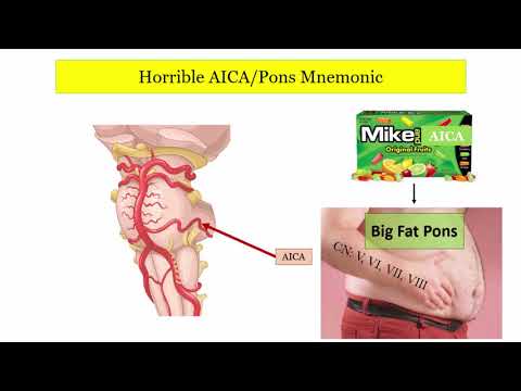 12DaysinMarch, Stroke Localization (Brainstem), Part 3 of 3 for the USMLE Step One Exam