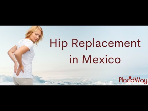 Walk With Ease after Hip Replacement in Mexico 