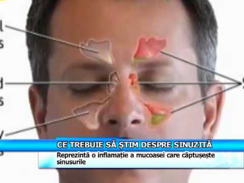 conexiunea vederii și mână la mână tricou test ochi