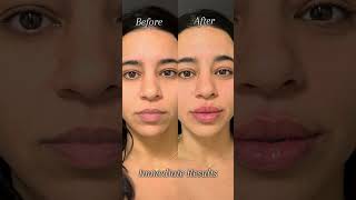 Lampert Md Plastic Surgery