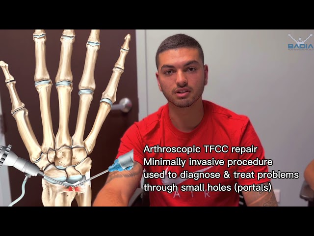 Professional tennis player from #australia had 4 failed procedures fly’s to the US for a solution