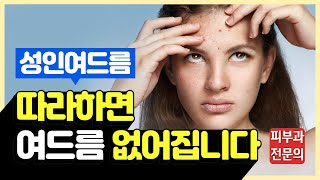 성인여드름 없애는 방법! 피부과에 헛돈 쓰지 말고 이것 하나만 바꿔보세요/여드름 유발 생활 습관 총정리!