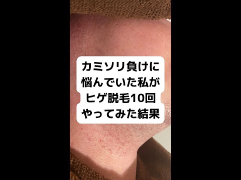 顔のチクチク – その原因と対処法