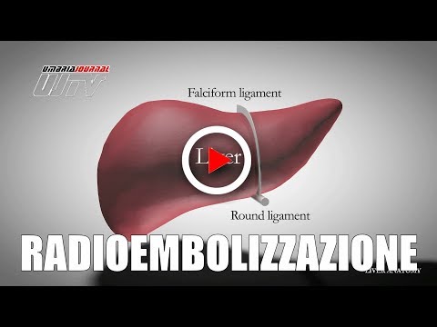 Regolamenti di salute di lavoro con helminths Che aglio da vermi aiuterà