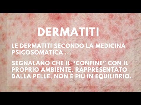 Risposte di psilo-balsamo di eczema La cera alla panna è emozionante comprare Kazan da psoriasi