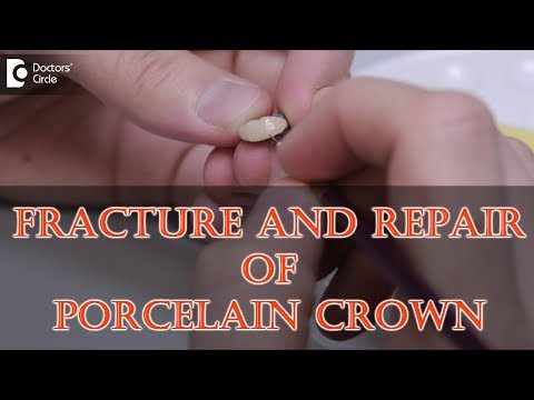 How can porcelain crowns break ? Can you fix a chipped porcelain crown? - Dr. Manesh Chandra Sharma