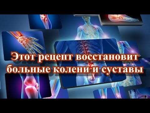 Деформирующий артроз коленного сустава 1 Остеохондроз можно ли есть помидоры