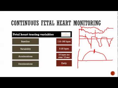 obstetrics (6): Fetal monitoring - continuous heart rate, NST, stress test, BPP, more