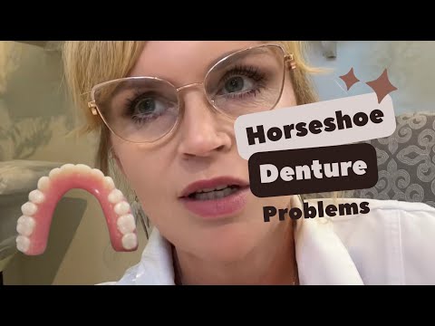 Horshoeing the Upper Denture, Expert Opinion
