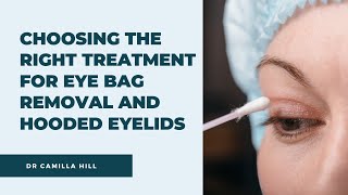 The right treatment for eye bag removal and hooded eyelids | Dr Camilla Hill