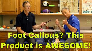 Foot Callous? This Product is AWESOME!