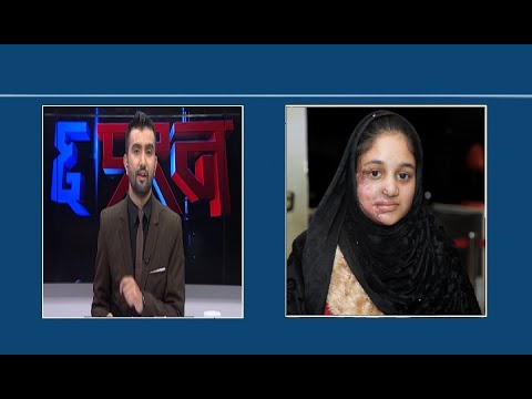 अपराधीले मुख जलाएपनि मेरो सपना जलाउन सकेको छैन : मुस्कान खातुन , एसिड पीडित - CHHA PRASNA