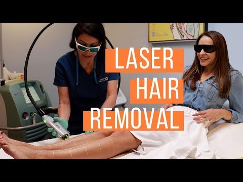 YouTube video about: How old can you get laser hair removal?