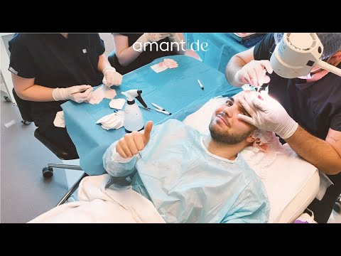 Video Amantide trapianto capelli Turchia