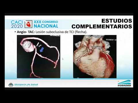 Videoposter CACI 2020 | Cortez J: ATC de TCI