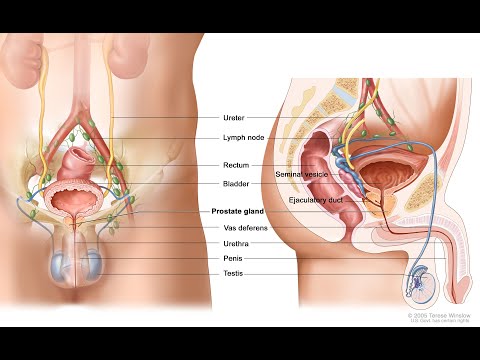 A prostatitis vizelet kezelése