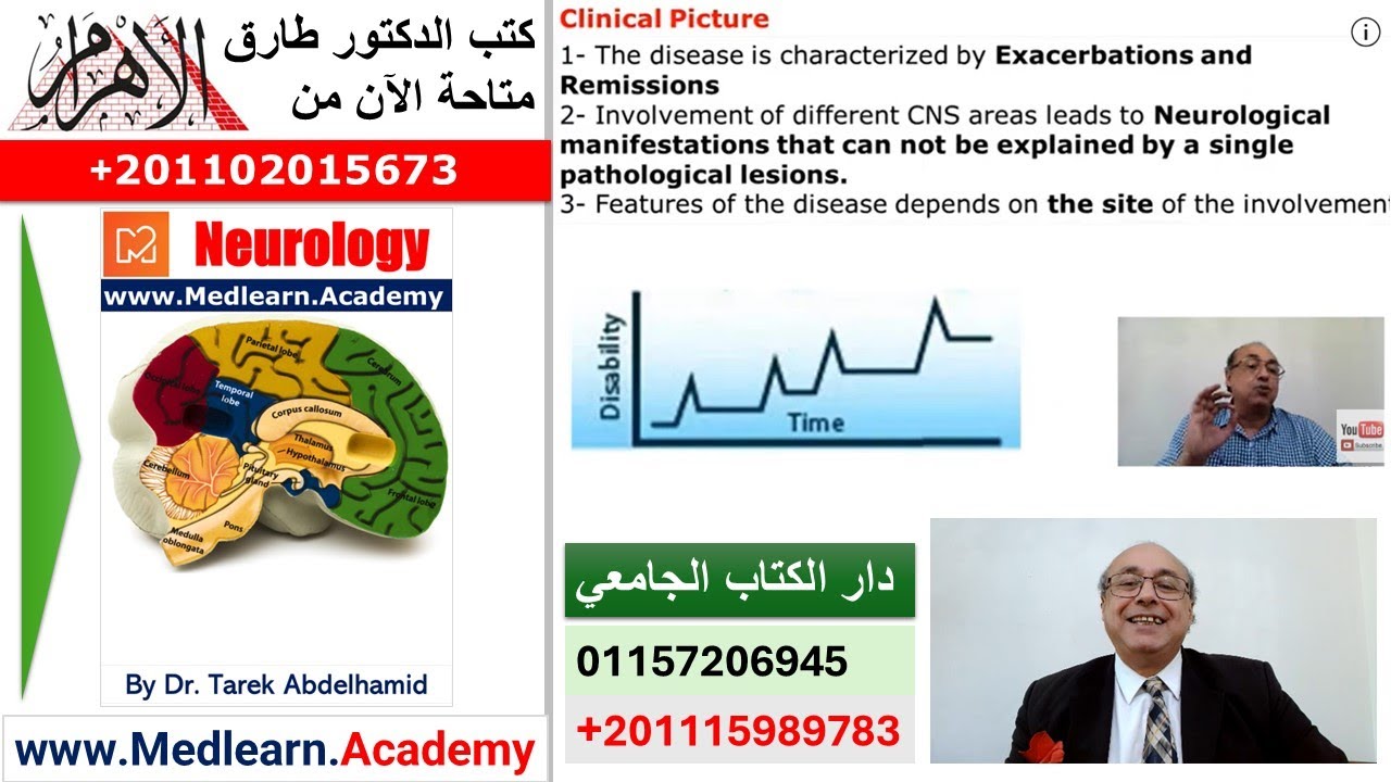 Multiple Sclerosis (MS)  #internal_medicine #cme #medicaleducation #محاضرات_باطنة #medicalcollege