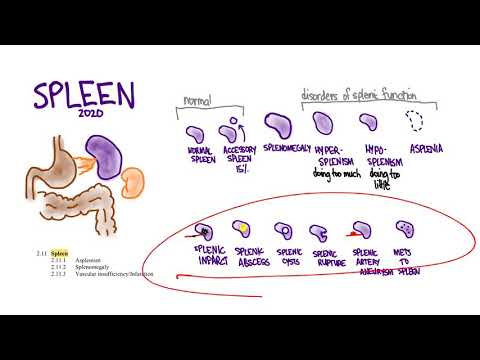 Splenic Abscess