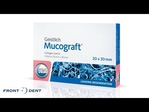 Hogyan használd a Mucograft-ot?