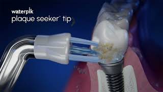 Waterpik Plaque Seeker™ Tip