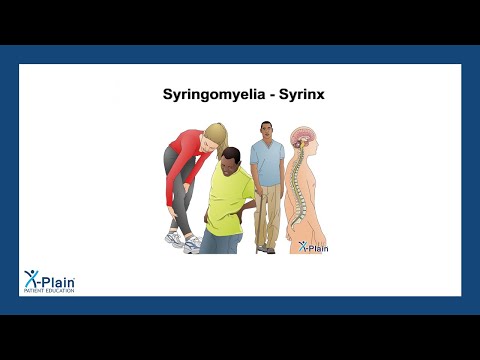 Syringomyelia - Syrinx