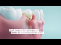Https Www Prodente De Fileadmin Redakteure Videos Kurzfilm Volkskrankheiten