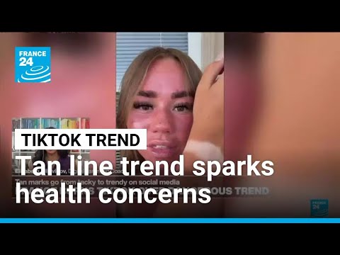 TikTok Tan line trend sparks health concerns