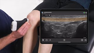 MSK AI