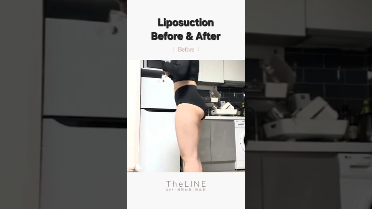 TheLINE shorts video