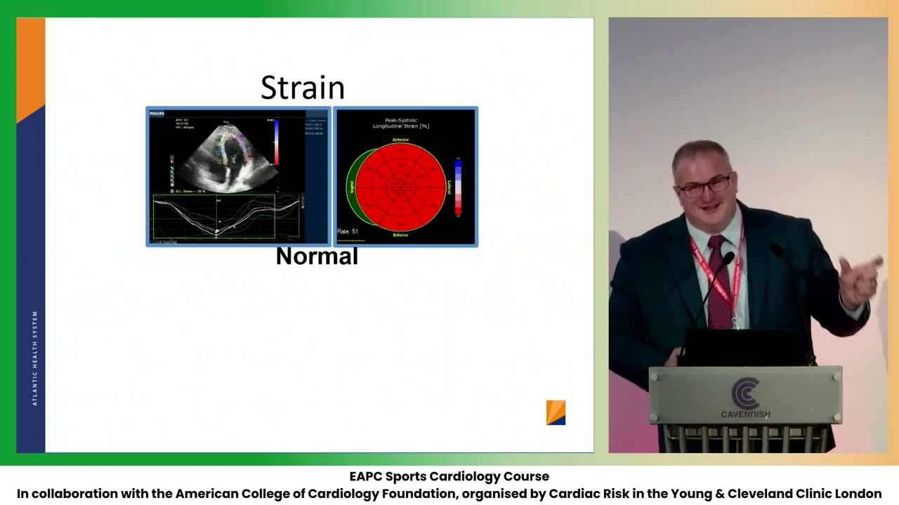 When does athletic adaptation become HCM - M  Martinez